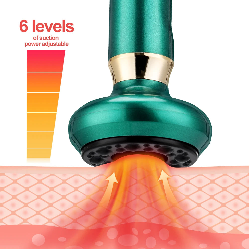 Intelligent Cupping Apparatus Rechargeable Magnetic Suction Body Massager for Cellulite Scraping and Cupping Massage Machine